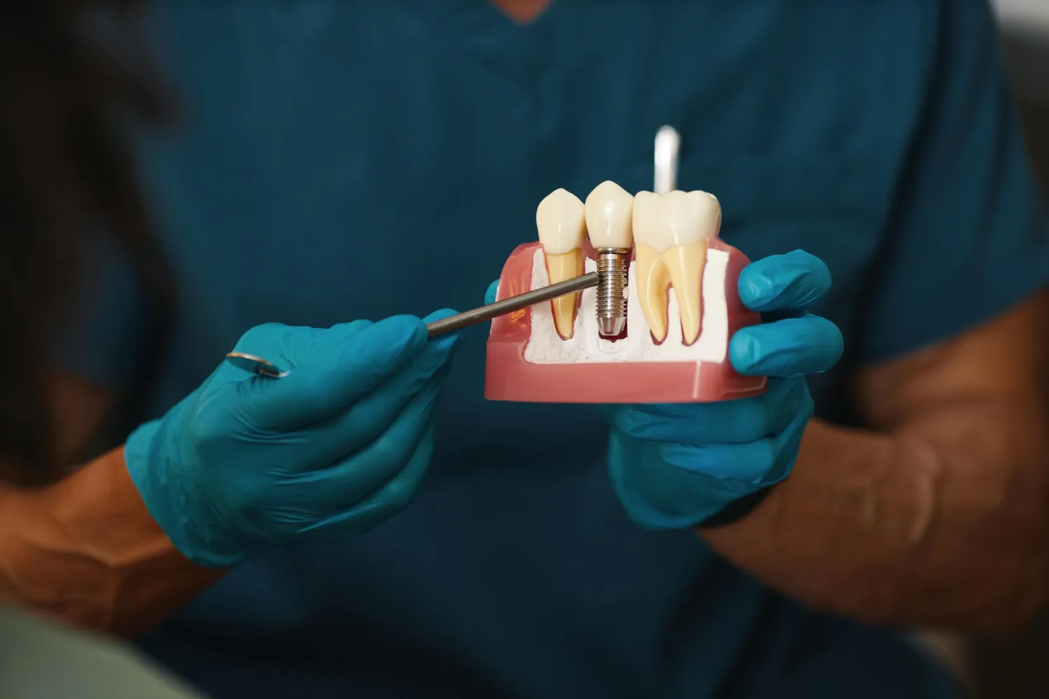 Dental professional demonstrating implant model