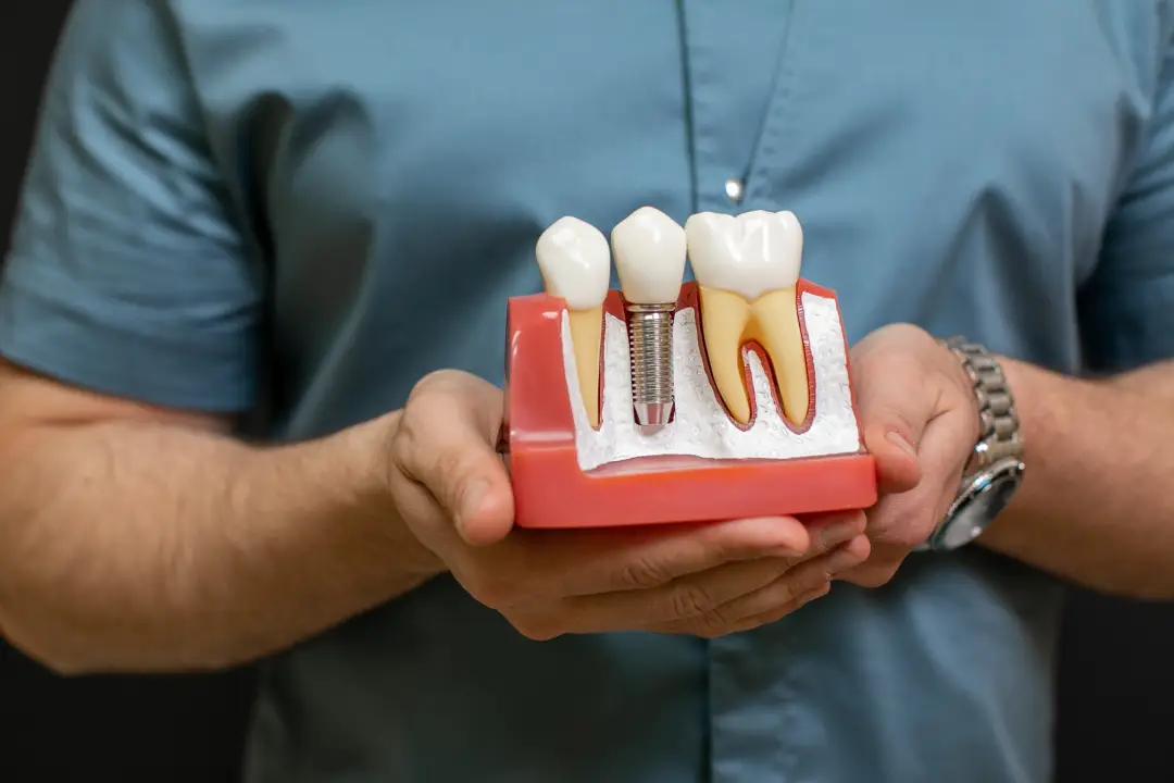 Dental Implants-Restorative Dentistry by Valley View Dental