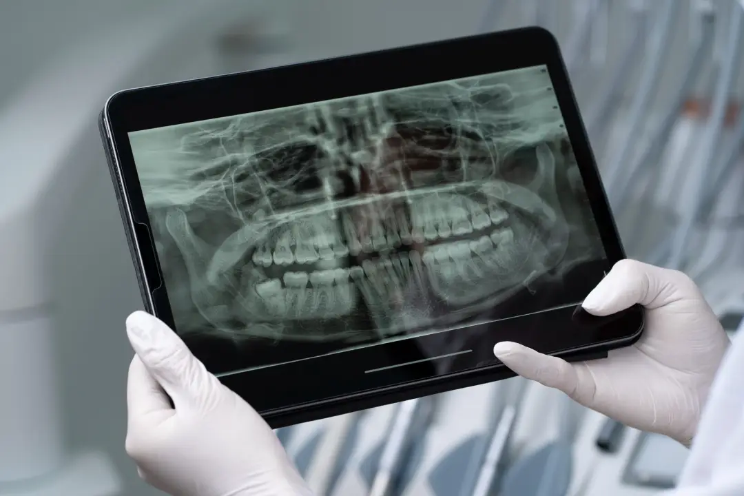Digital X-Rays-Advanced Dentistry by Valley View Dental