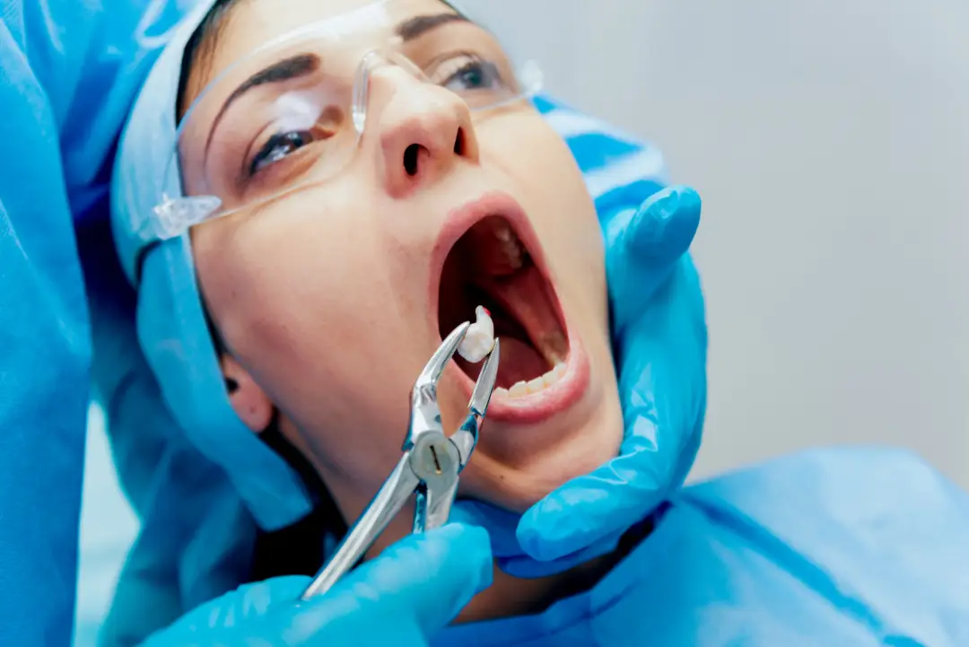 Wisdon Tooth Removal-Oral Surgery by Valley View Dental