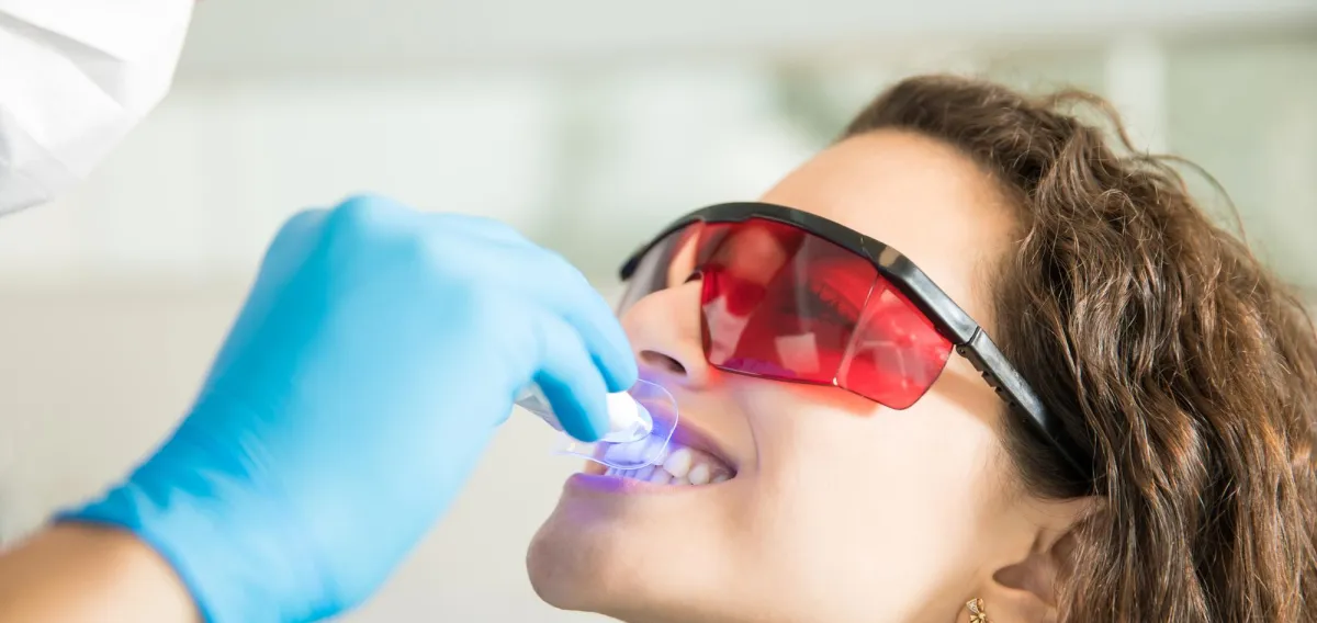 Opalescence-Teeth-Whitening-Cosmetic Dentistry Treatment at Dentique Dental Care